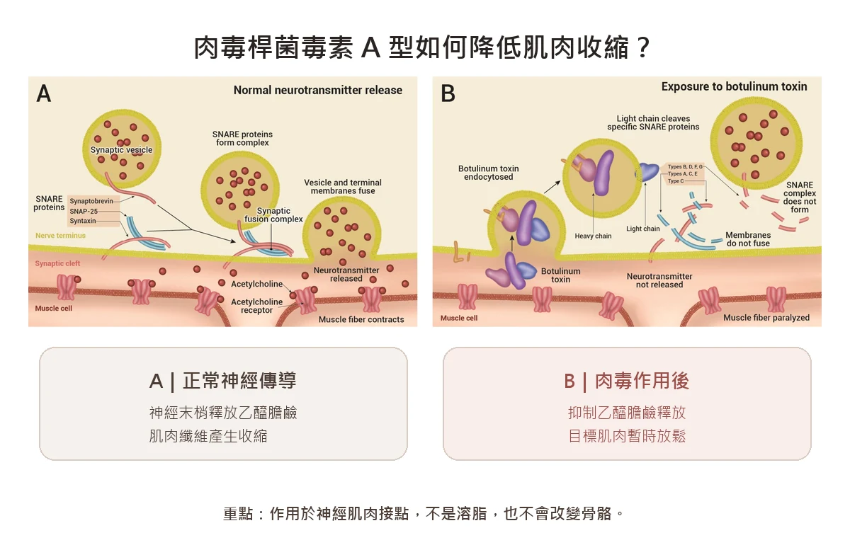 肉毒桿菌毒素A型抑制乙醯膽鹼釋放並使目標肌肉暫時放鬆的作用原理圖